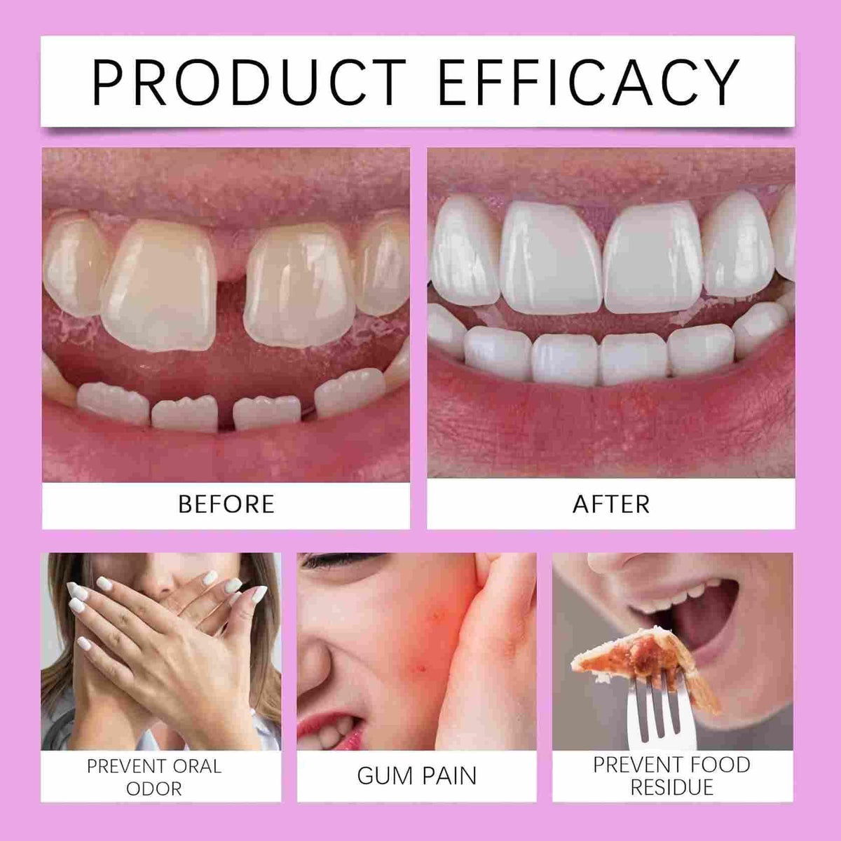 Adjustable Silicone Full-Mouth Denture Set X33774